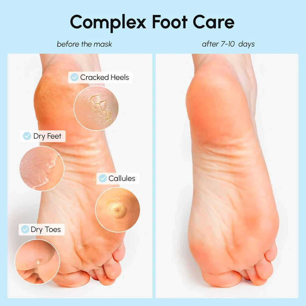 Exfoliating &amp; Hydrating Foot Mask