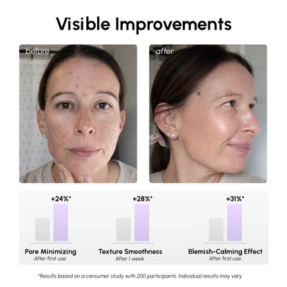 12% Niacinamide Smooth &amp; Glow Pads