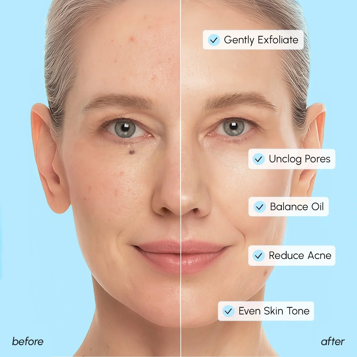 Glycolic &amp; Salicylic Acid Peel Pads