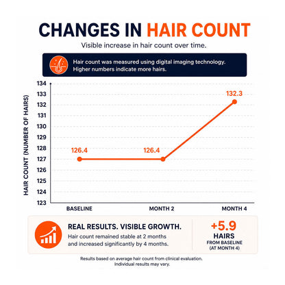 FOLIGAIN® Triple Action Conditioner For Thinning Hair For Men with 2% TRIOXIDIL®