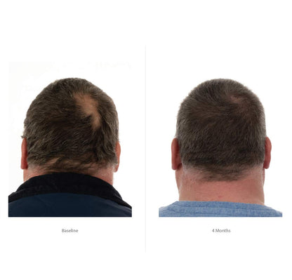 FOLIGAIN® Triple Action Shampoo For Thinning Hair For Men with 2% TRIOXIDIL® 473ml