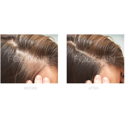 FOLIGAIN Minoxidil 2% three bottle hair treatment supply for women